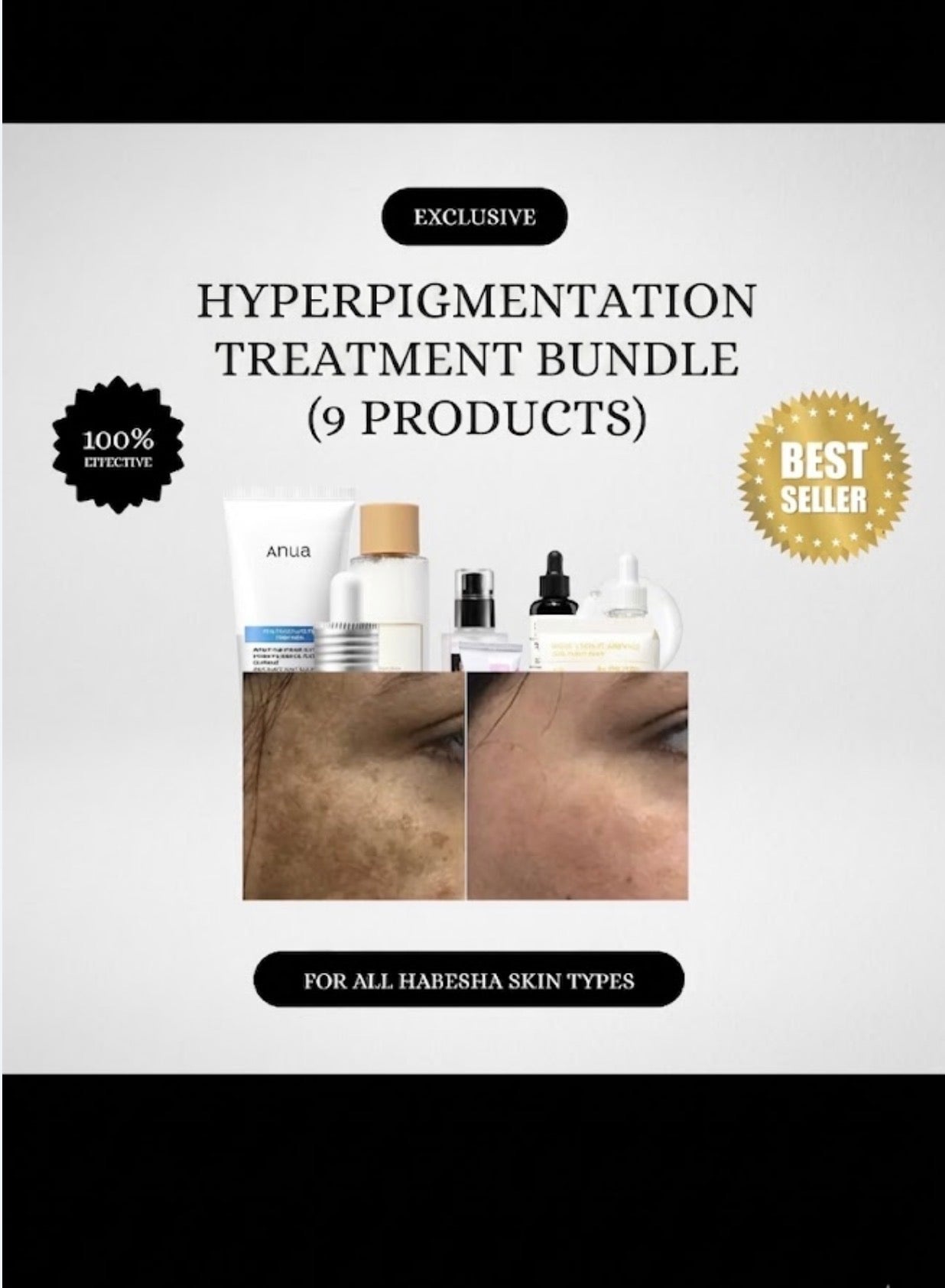 Hyperpigmentation Clearing Bundle ናይ ማዳ መጥፊኢ ኮምቦ (9 ፖሮዳክትስ) ዘጠቃለለ ምስ ኩሉ ዓይነት ገጽ ዝሰማማዕ✨