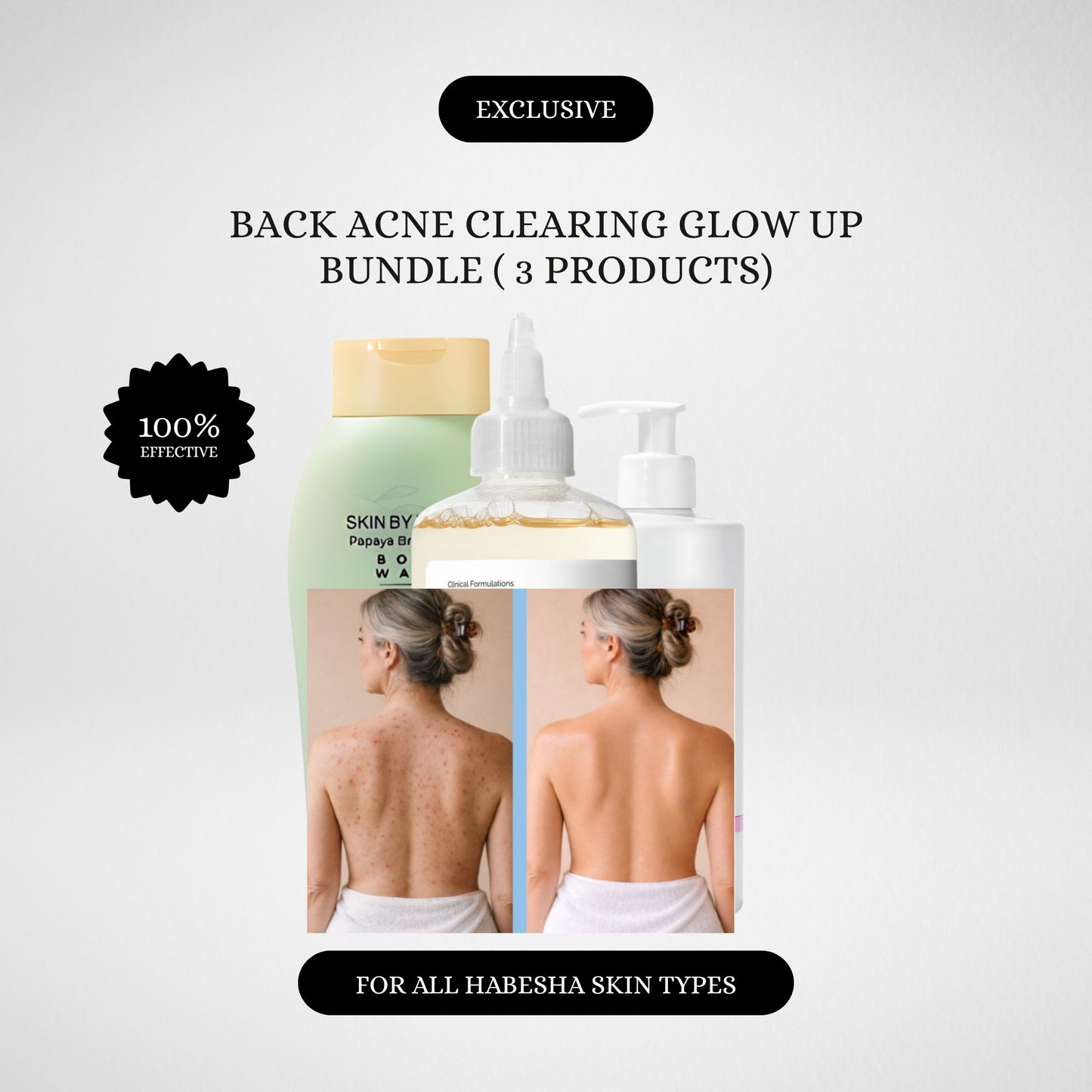 Back Acne Treatment & Radiant Skin Set ናይ ሕቅ ፈጸጋን ጸሊም ነጠብጣብን መጽረዪ ኮምቦ