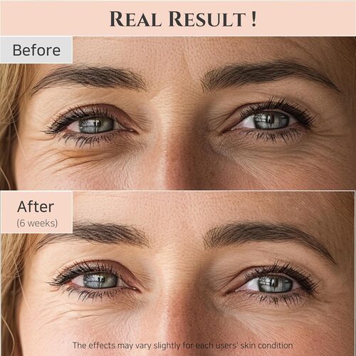 Beauty of Joseon Revive Eye Serum: Ginseng + Retinal 30ml