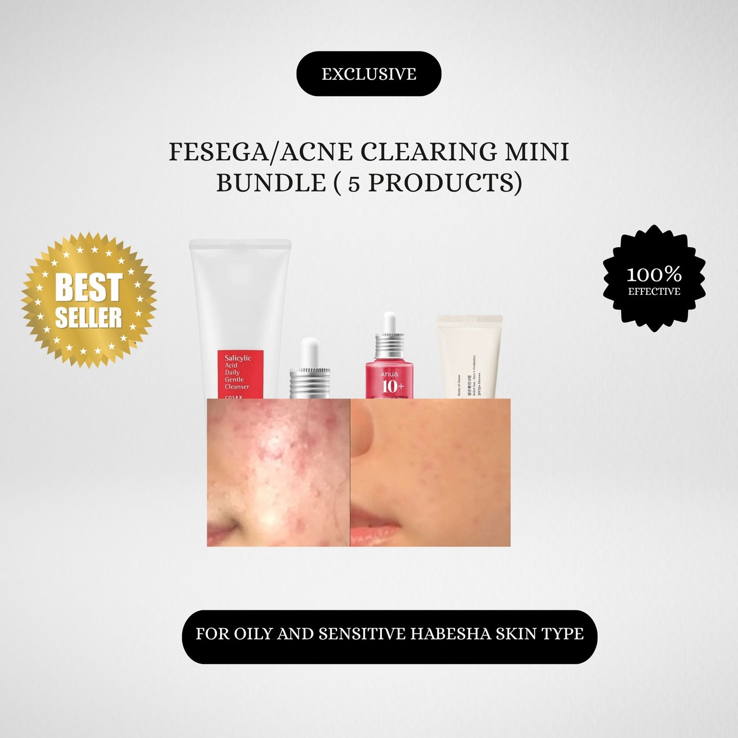 The Habesha Acne Clarifying Mini Bundle   ናይ ፈጸጋ መጽረዪ ኮምቦ ( 5 ፖሮዳክትስ ዘጠቃለለ)